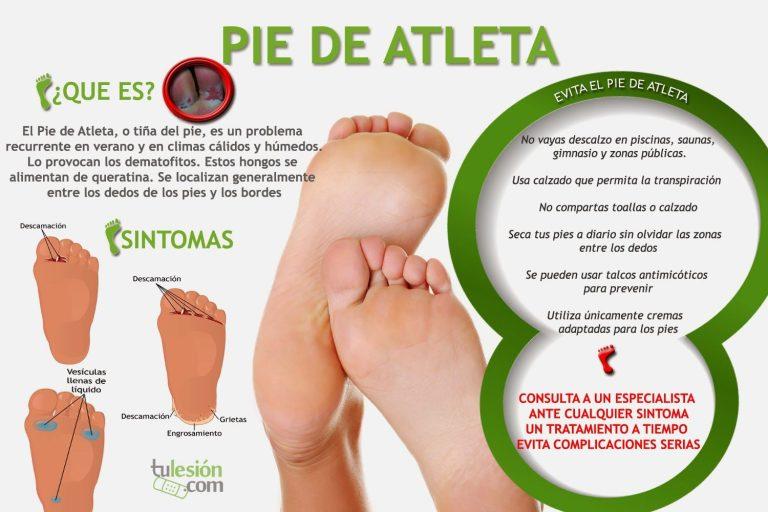 Hongos En Los Pies Qu Son Y C Mo Tratarlos Farmacia Online